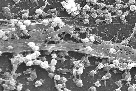 Antimicrobials Interacting with Bacterial Membranes